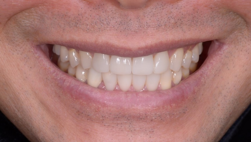 clinic case1-2.jpg